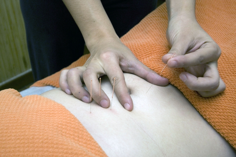 osteopathe-LA LONDE LES MAURES-min_acupuncture-4175625